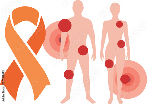chronic regional pain syndrome vector 