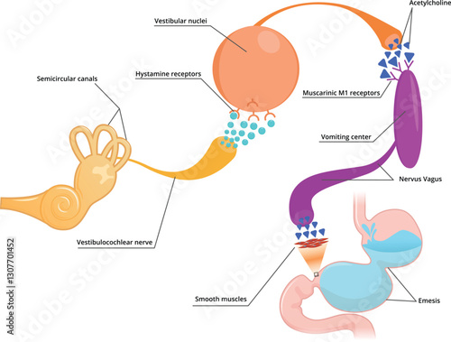 Motion sickness schematic illustration. What are the causes of motion sickness​