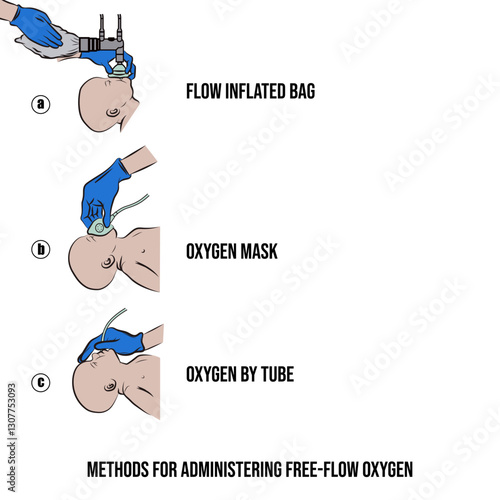 free flow oxygen delivery methods.