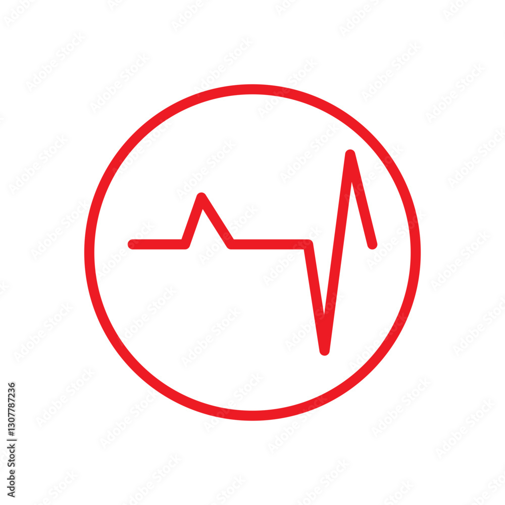 ECG SIGNS ECG SIGNS