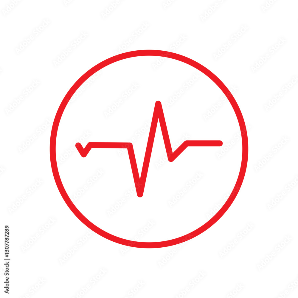 ECG SIGNS ECG SIGNS