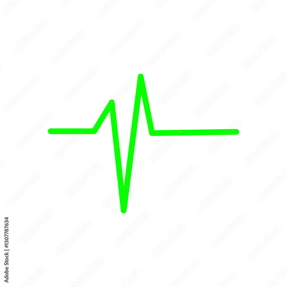 ECG SIGNS ECG SIGNS