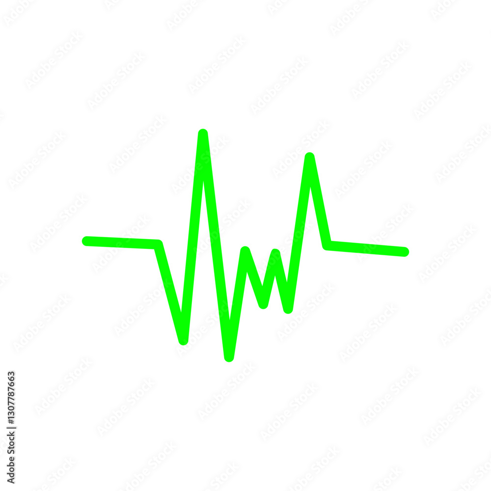 ECG SIGNS ECG SIGNS