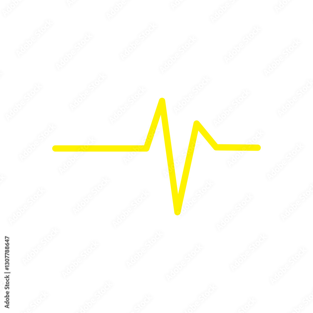 ECG SIGNS
