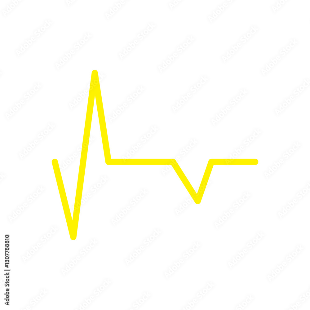 ECG SIGNS ECG SIGNS