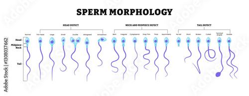 Different types of sperm morphology.  Normal, abnormal and defective human egg. Spermatozoon. Male Reproductive system. fertility diagram. Labeled head, midpiece, neck, tail defect.