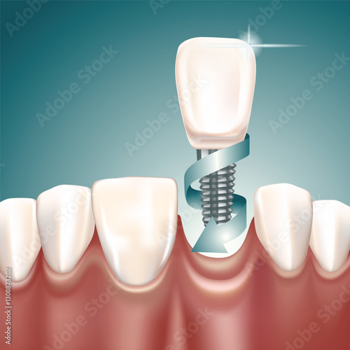 tooth implant and Arrow Vector, 3d Style