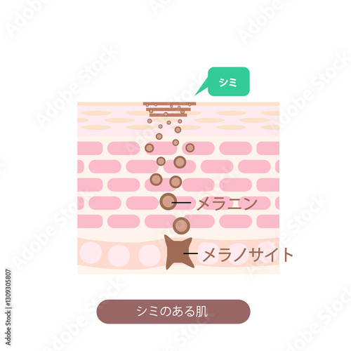 肌断面図で見せるシミのイラスト
