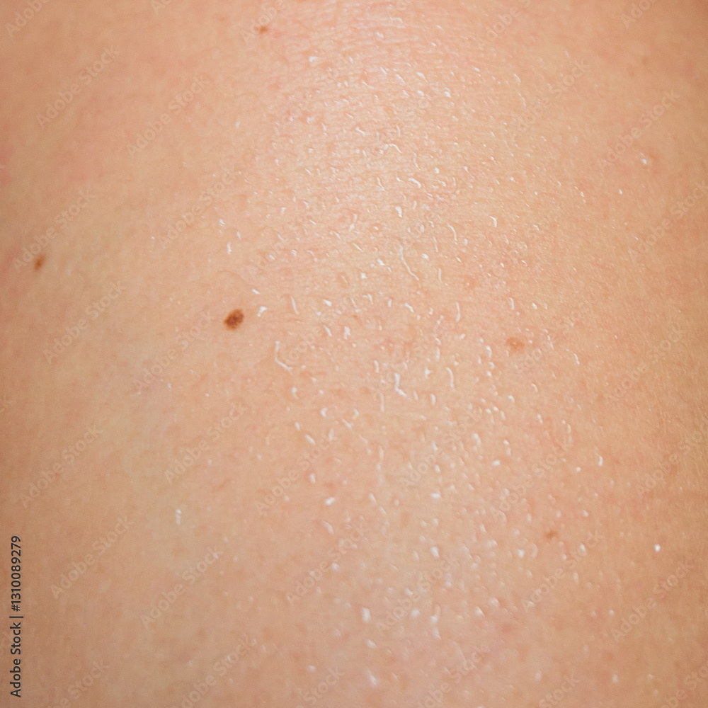 Fototapeta premium Detailed human skin with small moles and water drops, showcasing natural texture and hydration