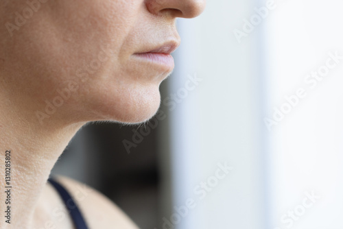 Photos Unwanted facial hair
