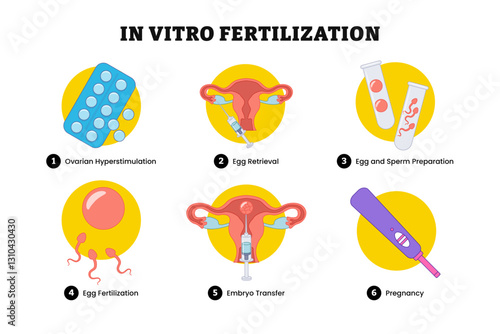 In Vitro Fertilization steps guide infographic poster design, medical illustration. Labeled Ovarian hyperstimulation, egg retrieval, egg and sperm preparation, egg fertilization, embryo transfer.