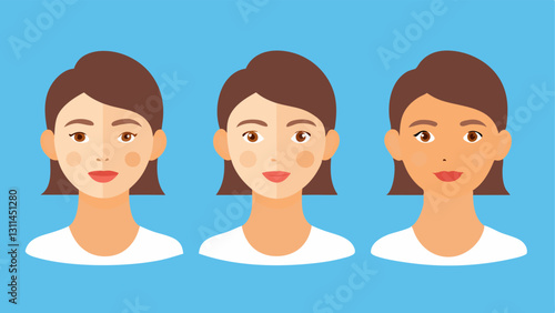 TimeLapse Progression A series of three faces showing gradual improvement from rough skin to smooth skin over time with clear labels indicating the stages of treatment.