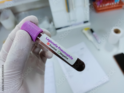 Scientist hold blood sample for Legionella Pneumophila Positive test tube. Healthcare and medical test concept.