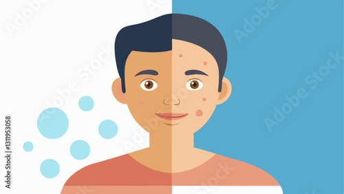 Skin Texture Improvement A vector depiction of skin texture improvement showing the transition from rough and patchy to smooth and radiant.