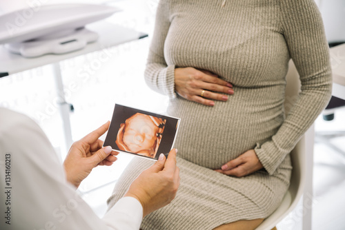 Gynecologist showing ultrasound scan to pregnant woman