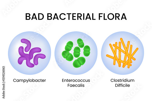 Bad Bacterial Flora Medical Illustration
