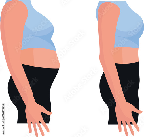 Excess belly fat before and after images visually document the transformation of the abdominal area following weight loss, fitness training, diet changes, or cosmetic procedures like liposuction