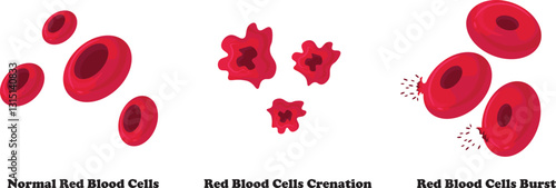 Blood crenation and burst depict abnormal changes in red blood cells where crenation refers to the shrinkage and spiky deformation of cells due to hypertonic solutions, while bursting (hemolysis) occu