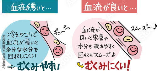 血流が良い時と悪い時の血管内の状態とむくみやすさをわかりやすくしたイラストと手書き文字