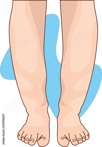 lower limb swelling illustration extending to below knee