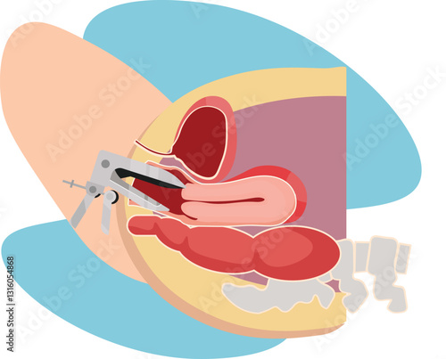 cervical examination using speculum to look for underlying pathology