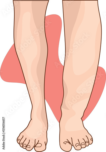lower limb swelling illustration extending to below knee