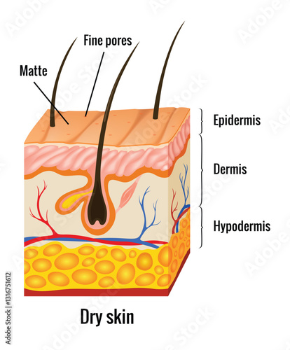 Obraz na płótnie Dry skin anatomy. Human body skin vector illustration with parts vein artery hair sweat gland epidermis dermis and hypodermis. Human Cross-section of the skin layers structure w salonie