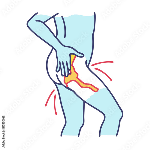 Hip pain illustration with highlighted nerves