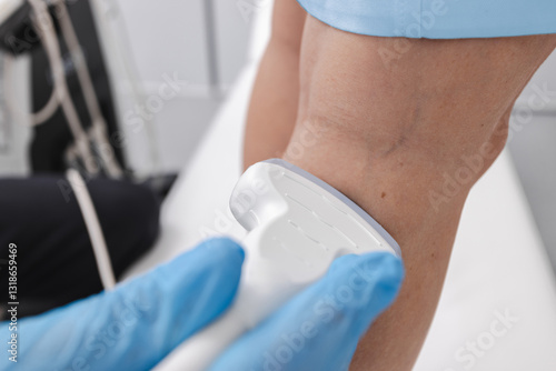 Photos Ultrasound vascular diagnostics process of female patient's legs with varicose veins, close-up