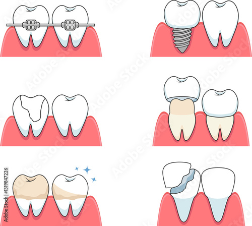 Dental treatment. Vector illustration of common dental procedures and care