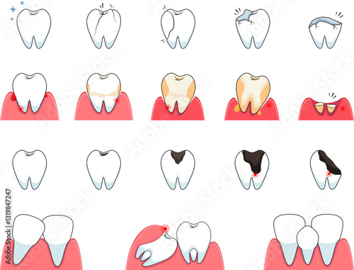 Problems with teeth. Vector illustration of common dental issues
