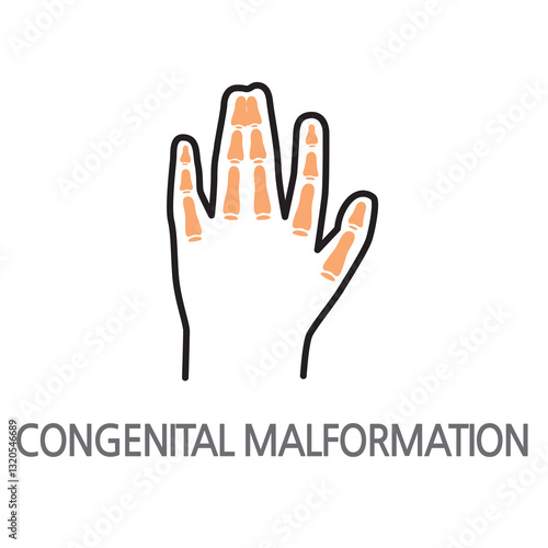 10.Congenital Malformation.eps. Deformation, congenital deformity icon. Edible deformity, congenital deformity linear illustration icon on white background. EPS, PNG, JPG