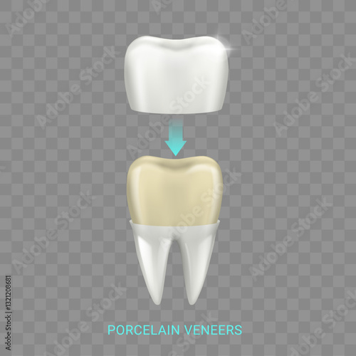 Porcelain veneers, dental prosthetics and stomatology and orthodontic help to patients with teeth problems. Vector tooth treatment and procedures for hygiene. Reconstruction of dent and enamel