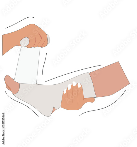 Gypsum bandage.Sprained ankle foot with elastic bandage
