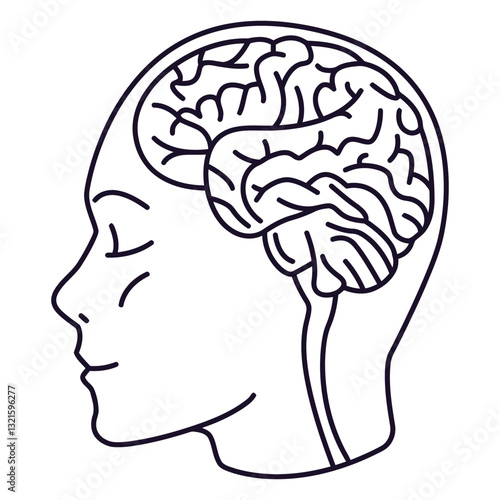 persons brain stroke.
