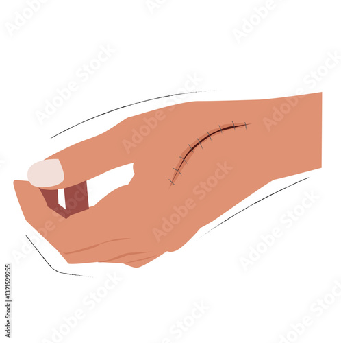 stitched wound hands.Injured human arm