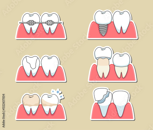 Dental care and treatment. Vector sticker set of common procedures and oral health
