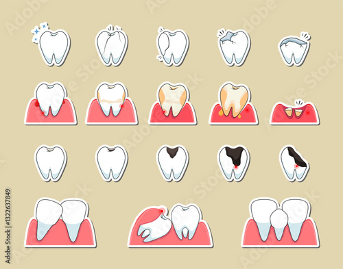 Dental problems. Vector sticker set of common tooth issues