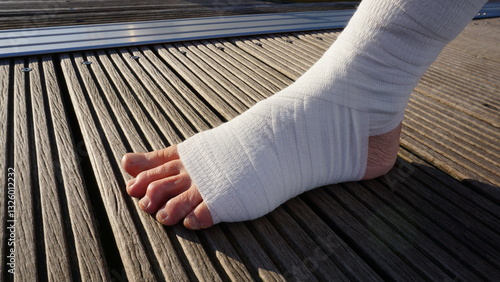 Foot wrapped in bandage. A first aid procedure with bandages and aid provided to injuries and damage. Care of injured persons in accidents.