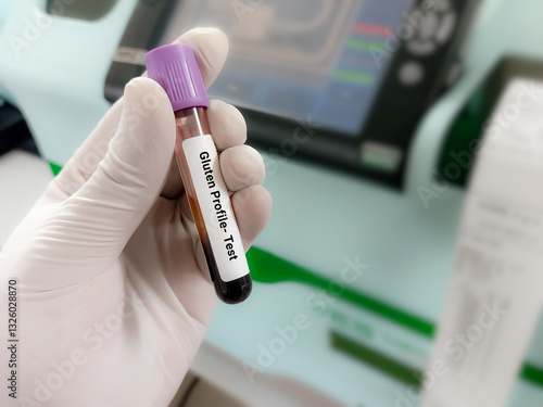 Doctor hold Blood sample for Gluten Profile test. Healthcare and medical test concept.