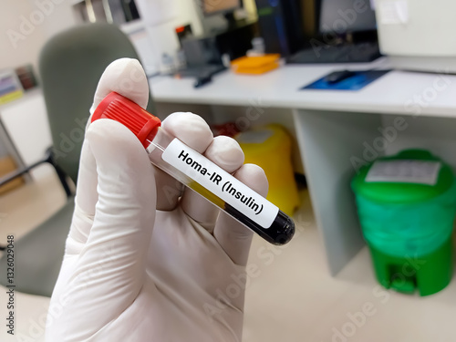 Doctor hold Blood sample for Homa IR (Insulin) test. Healthcare and medical test concept.