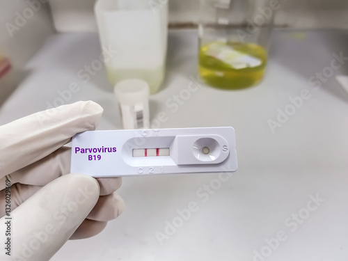 Scientist hold  rapid cassette for Parvovirus B19 test. Healthcare and medical test concept.