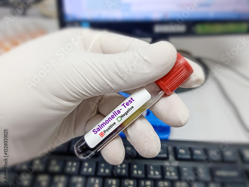 Scientist hold blood sample for Salmonella Positive result test tube. Healthcare and medical test concept. photo