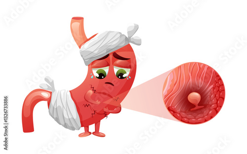 Polyps in stomach, cute cartoon character with stomach in pain. Sad stomach is wrapped in bandages. Vector illustration