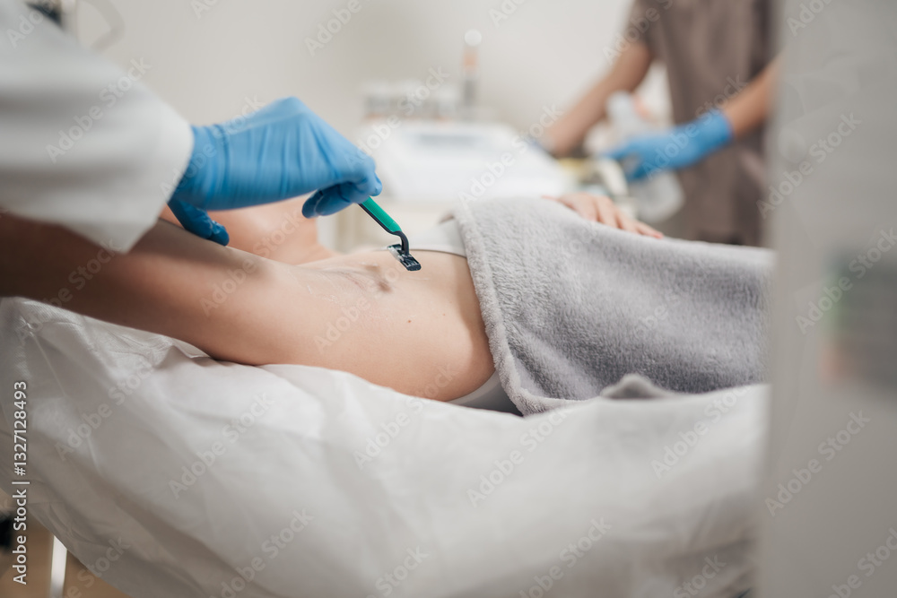 Closeup hand of a specialist shaves her underarm with a razor to ensure a smooth treatment. Preparing for underarm laser hair removal procedure at a modern aesthetic clinic. Closeup hand of a specialist shaves her underarm with a razor to ensure a smooth treatment. Preparing for underarm laser hair removal procedure at a modern aesthetic clinic.