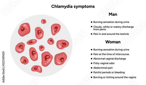 Chlamydia Trachomatis symptoms. Woman’s and man's reproductive system infections. Medical disease 