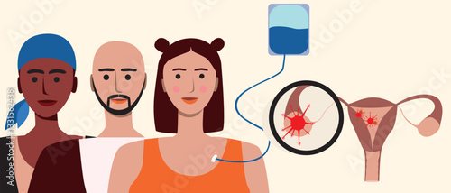 Cancer patients silhouettes and cancer ribbon, silhouette vector stock illustration with unidentifiable people together as a template with space for text or copy space