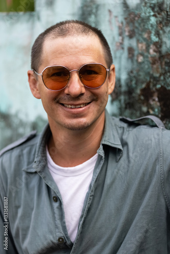 An attractive light-skinned Caucasian man after a hair transplant. 
