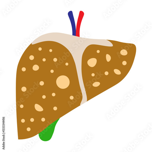hemochromatosis