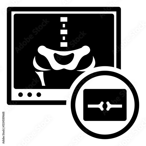 X-Ray